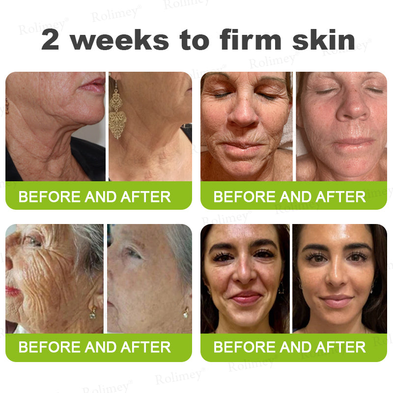 🧠👨‍⚕️Made and shipped from the USA 💫NATRAVOR® Botox & Vita-A Retinol Shot Wrinkle-Lift Tightening cream - Last Day Promotion 70% OFF