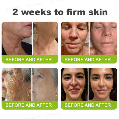 🧠👨‍⚕️Made and shipped from the USA 💫NATRAVOR® Botox & Vita-A Retinol Shot Wrinkle-Lift Tightening cream - Last Day Promotion 70% OFF