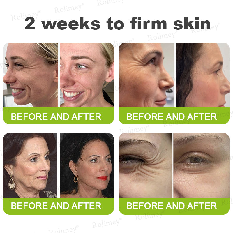 🧠👨‍⚕️Made and shipped from the USA 💫NATRAVOR® Botox & Vita-A Retinol Shot Wrinkle-Lift Tightening cream - Last Day Promotion 70% OFF