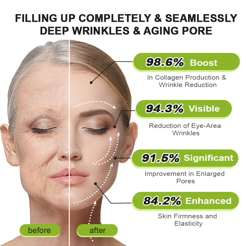 🧠👨‍⚕️Made and shipped from the USA 💫NATRAVOR® Botox & Vita-A Retinol Shot Wrinkle-Lift Tightening cream - Last Day Promotion 70% OFF