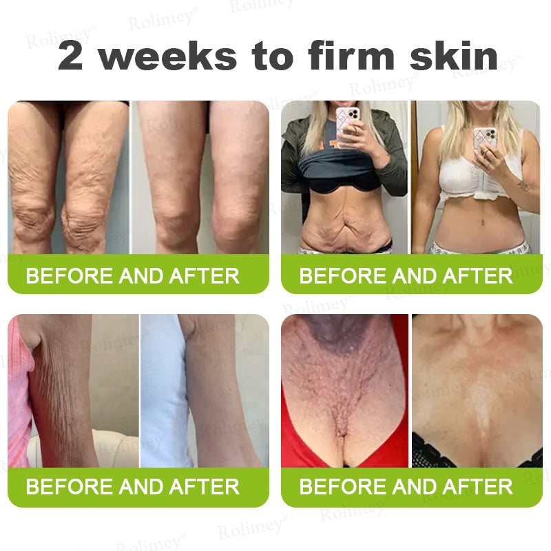 🧠👨‍⚕️Made and shipped from the USA 💫NATRAVOR® Botox & Vita-A Retinol Shot Wrinkle-Lift Tightening cream - Last Day Promotion 70% OFF