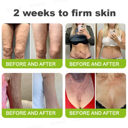 🧠👨‍⚕️Made and shipped from the USA 💫NATRAVOR® Botox & Vita-A Retinol Shot Wrinkle-Lift Tightening cream - Last Day Promotion 70% OFF